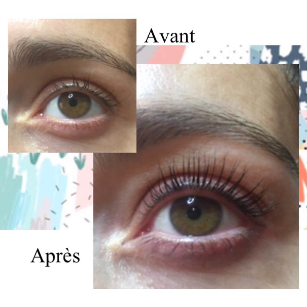 avant apres 2