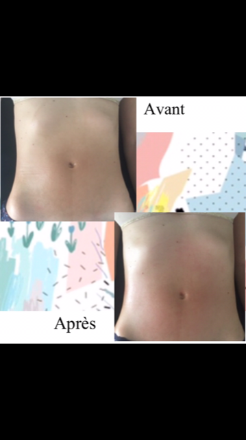 avant apres drainage 1