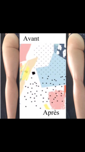 avant apres drainage 2